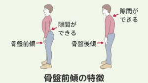 後面座位|「骨盤の前傾・後傾をつくる要因と、それにより起こ。